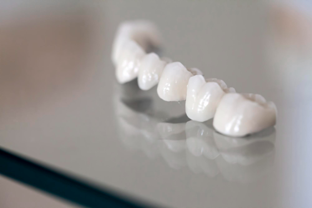 Dental Crowns