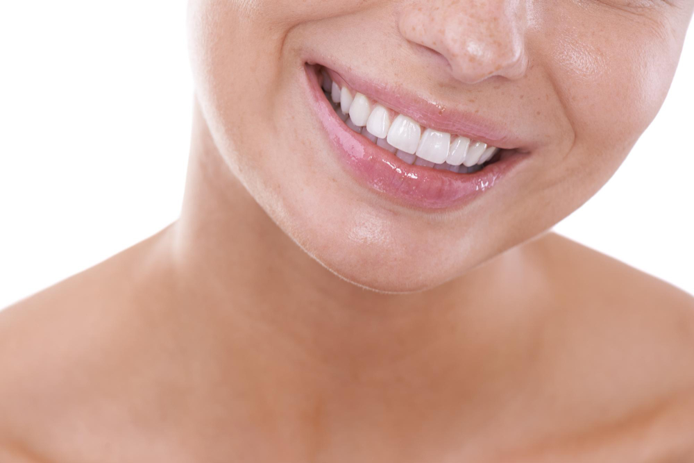 Dental Sealants