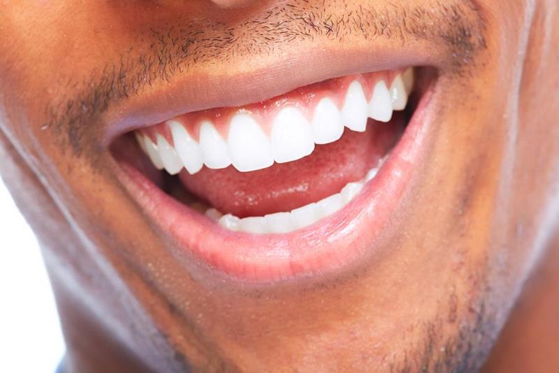 Implant retained dentures at Picasso Dental